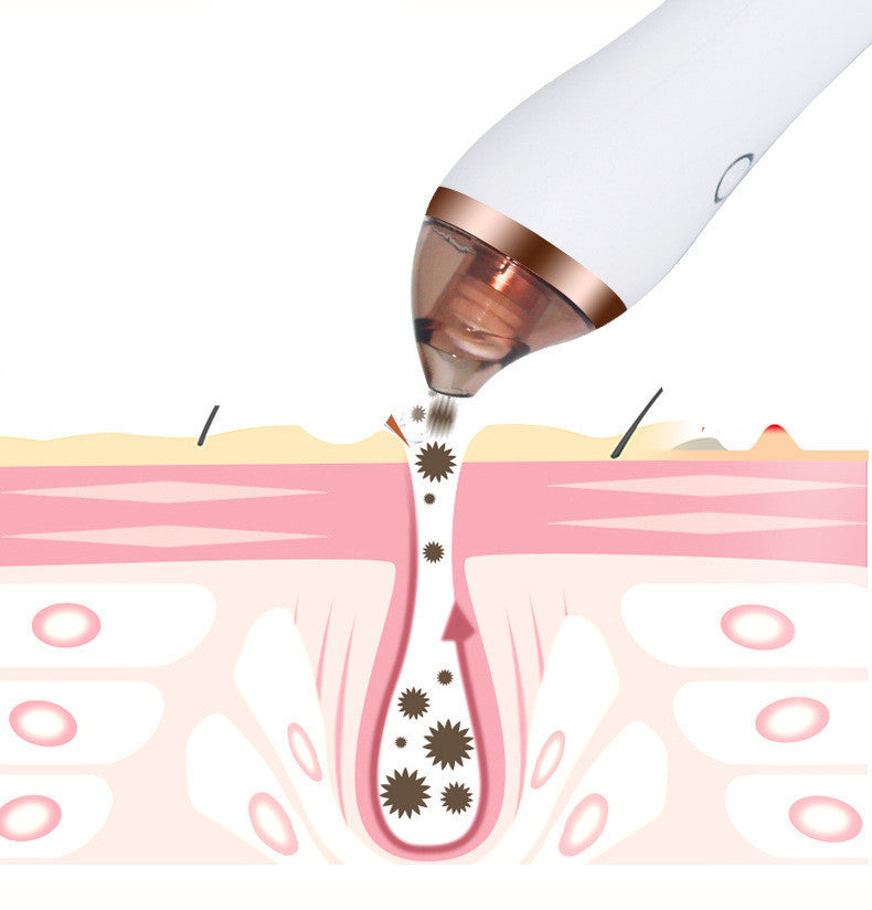 4 in 1 Body Guasha Cupping Blackhead Remover Machine Facial Pore Deep Cleansing Beauty Skin Care - HD Wireless Product #3