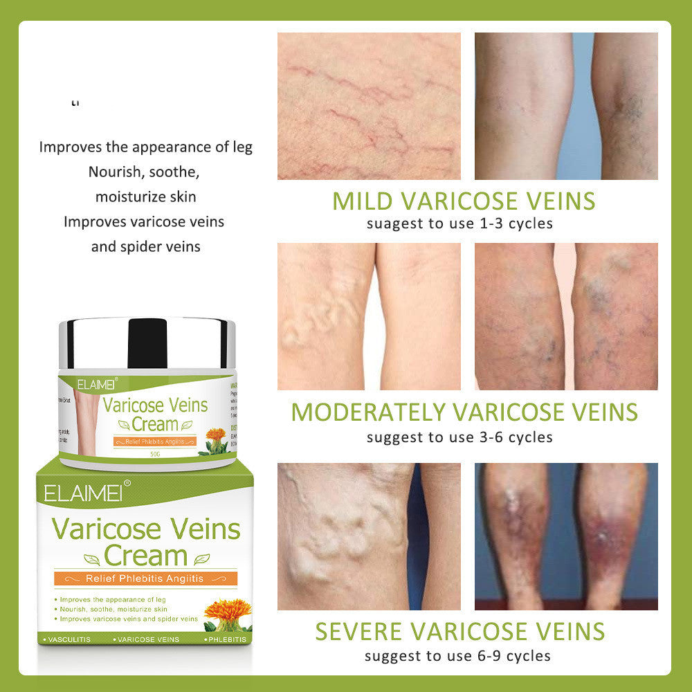 Vein red blood streak repair cream 121679048320