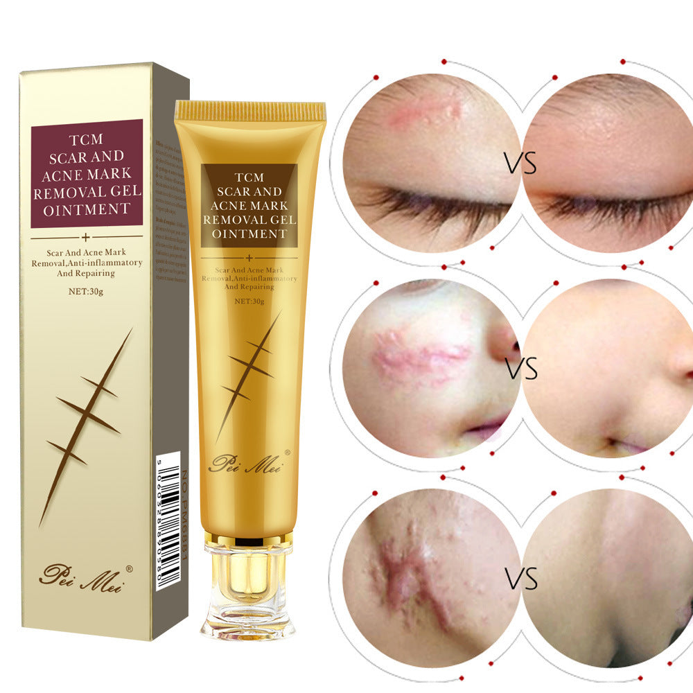 Light Scar Cream Scar Fine Grain Desalination Skin Care Products 1345378059725