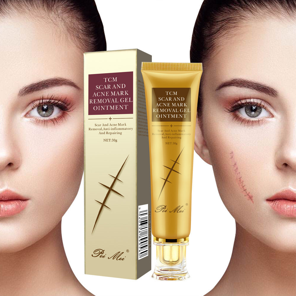 Light Scar Cream Scar Fine Grain Desalination Skin Care Products 146264739935