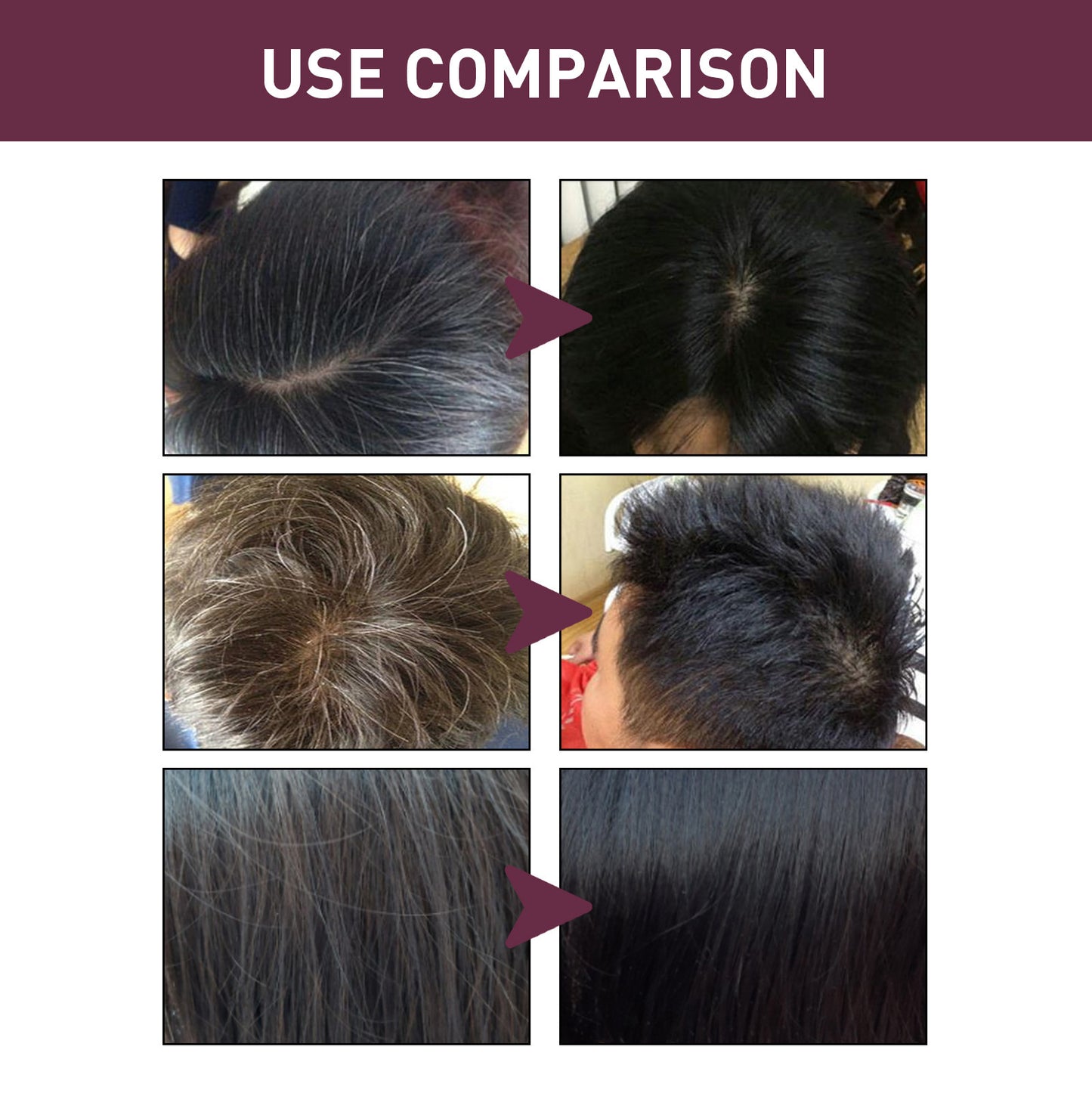 Hair Care Polygonum Multiflorum Shampoo Soap 2401270830590325600
