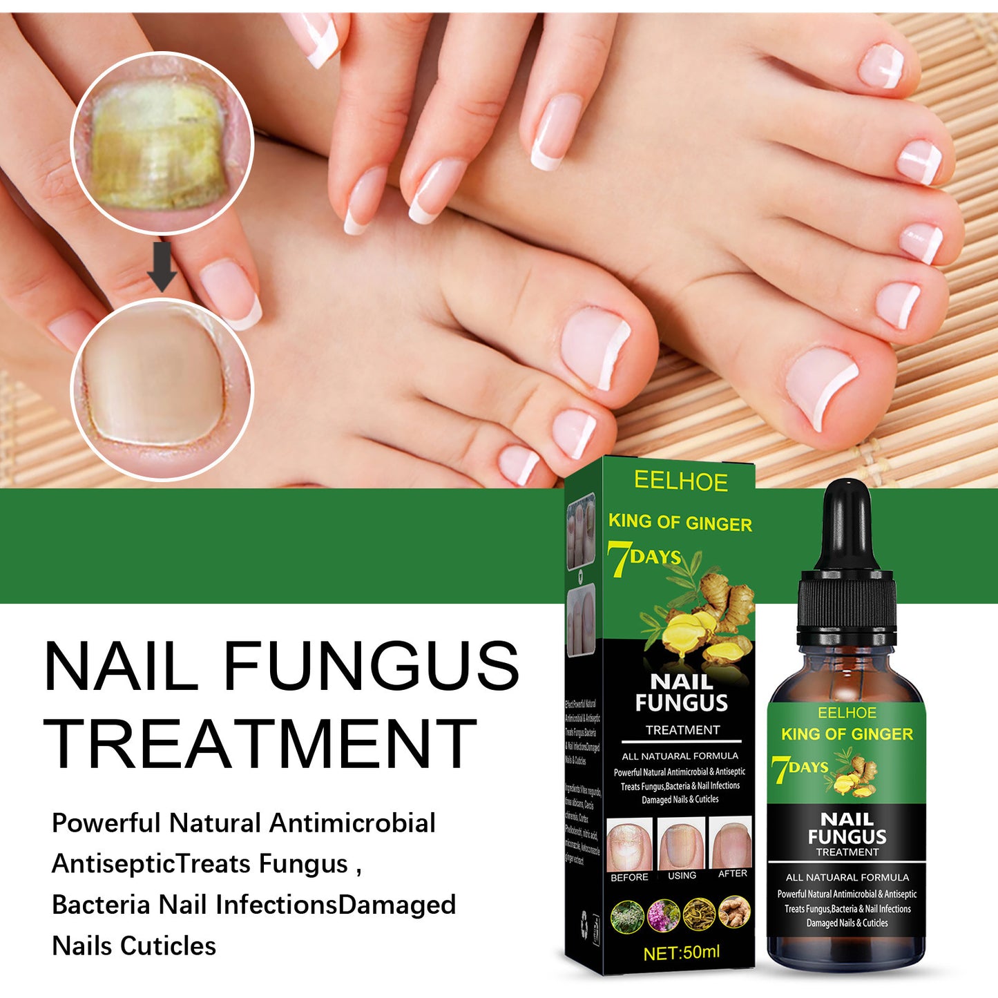 Nail Repair Solution Hand Foot And Nail Care Solution 2a19fca9 6216 4cf8 bf00 a96bbc433856