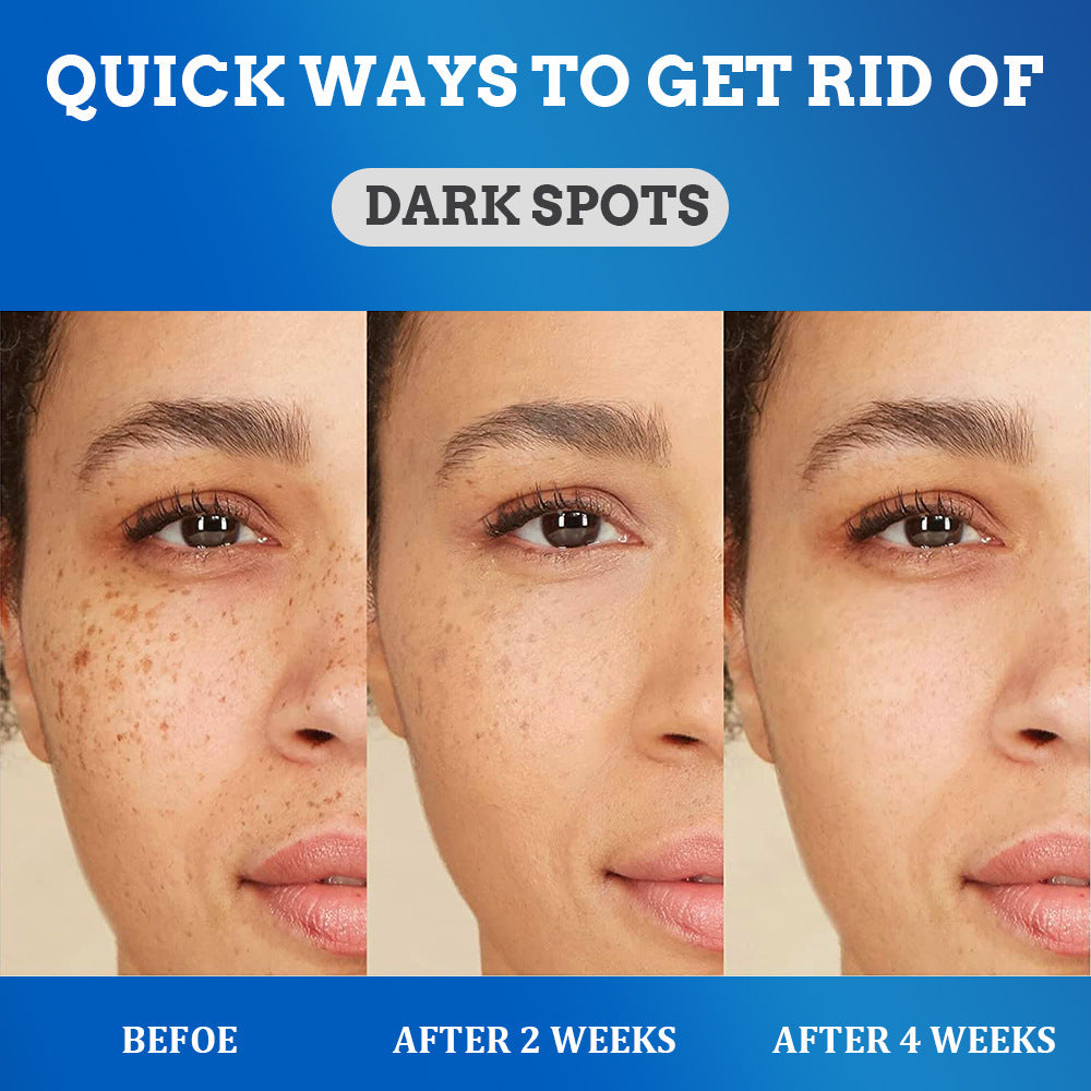 Fade Spot Cream Brightening White Moisturizing Cream 30bf7e63 5b80 435e 81e2 bf350e7b8859