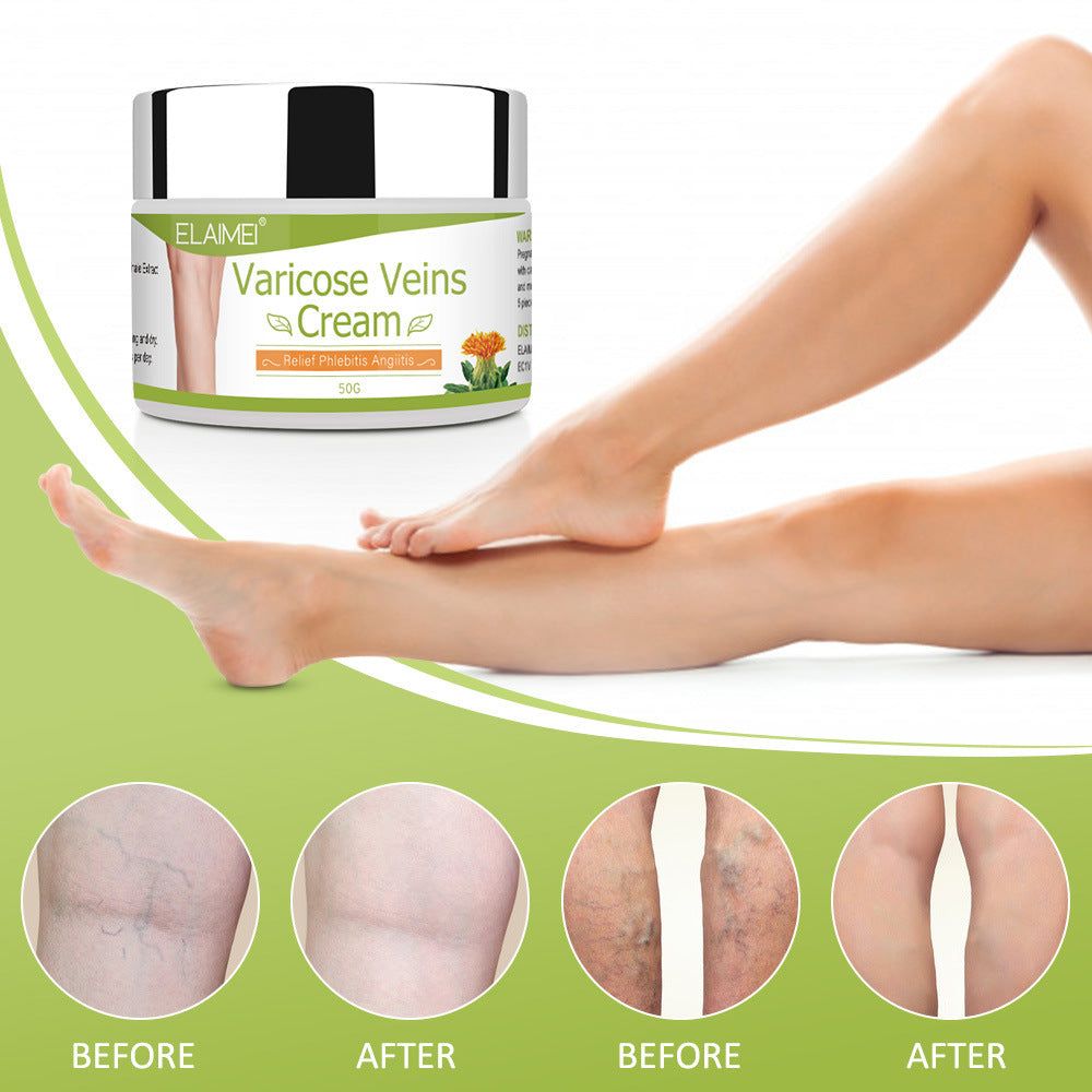 Vein red blood streak repair cream 3639117554638