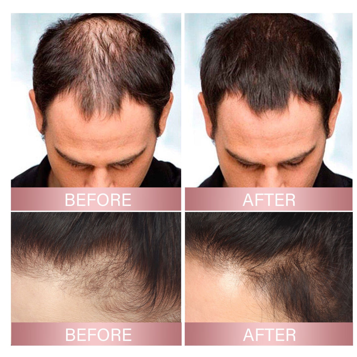 Strong Repair Rice Dense Hair Spray Hair Follicle Hair Root Anti-drop 3e47d674 8ff1 47cb b0a0 8f6928012459
