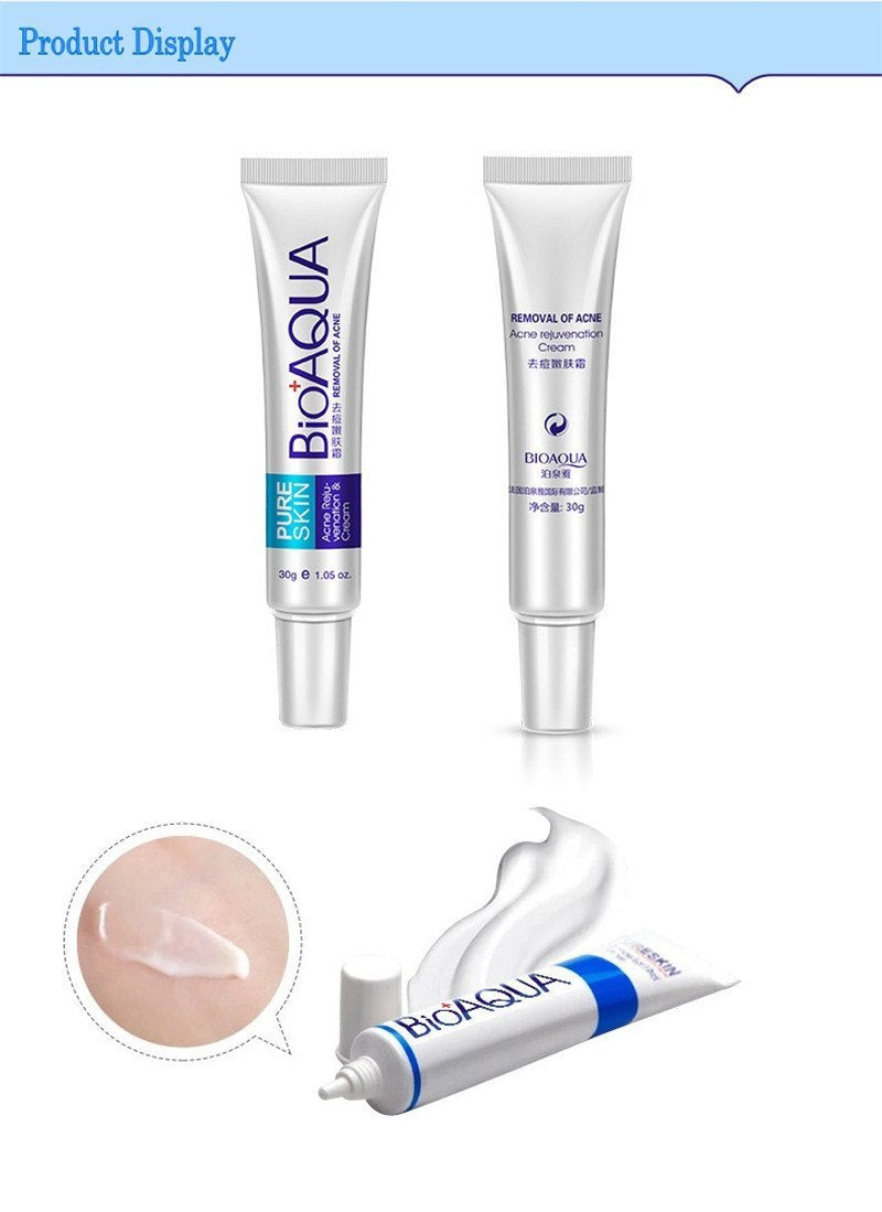 Anti Acne Cream Oil Control Shrink Pores Nourish Skin Acne Scar Remove Face Cream 403077284428