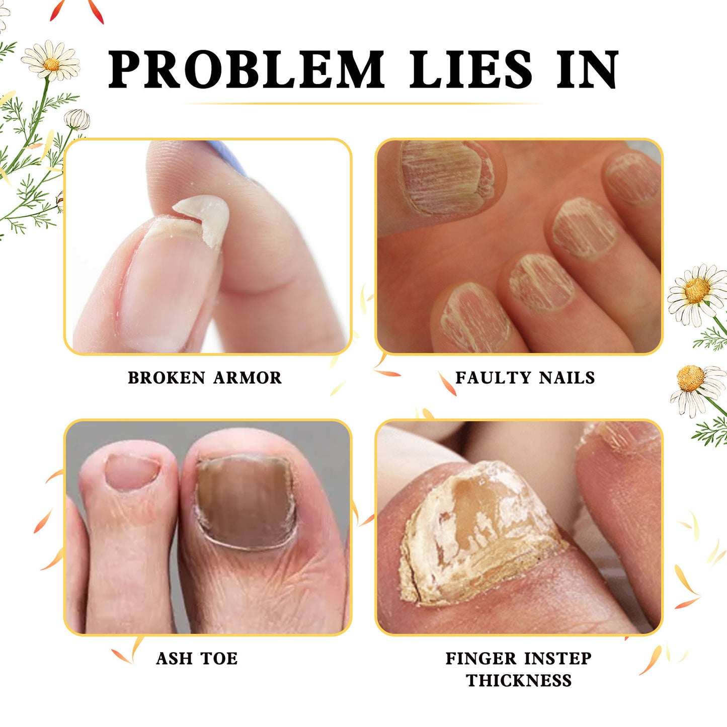 Hand And Foot Gray Nail Soft Yellow Thickening Bright Cleaning Repair a77110e3 b5b4 40bc a03d ce67ac564eb6