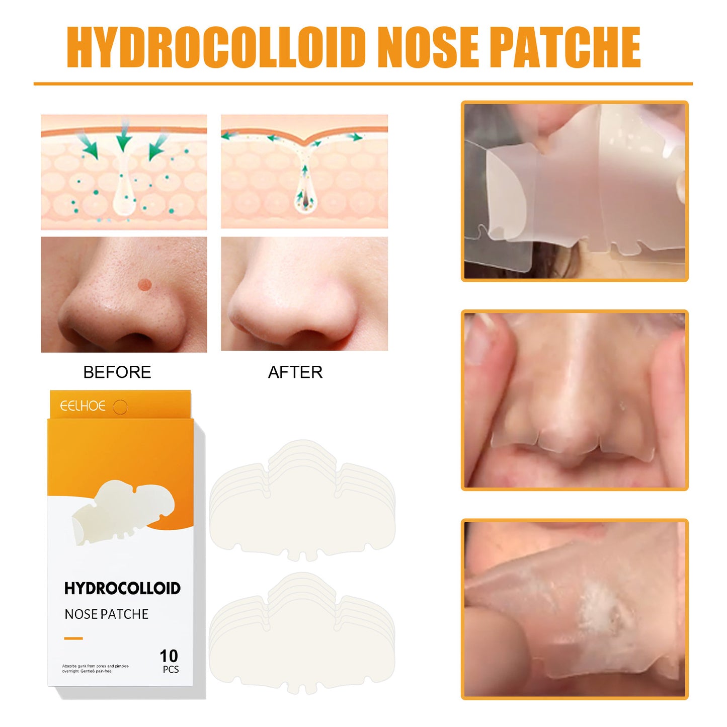 Nose Stick Clean Pore Gentle Care Peel bd6b3e4b 2b42 4380 8278 d2fe154844c5