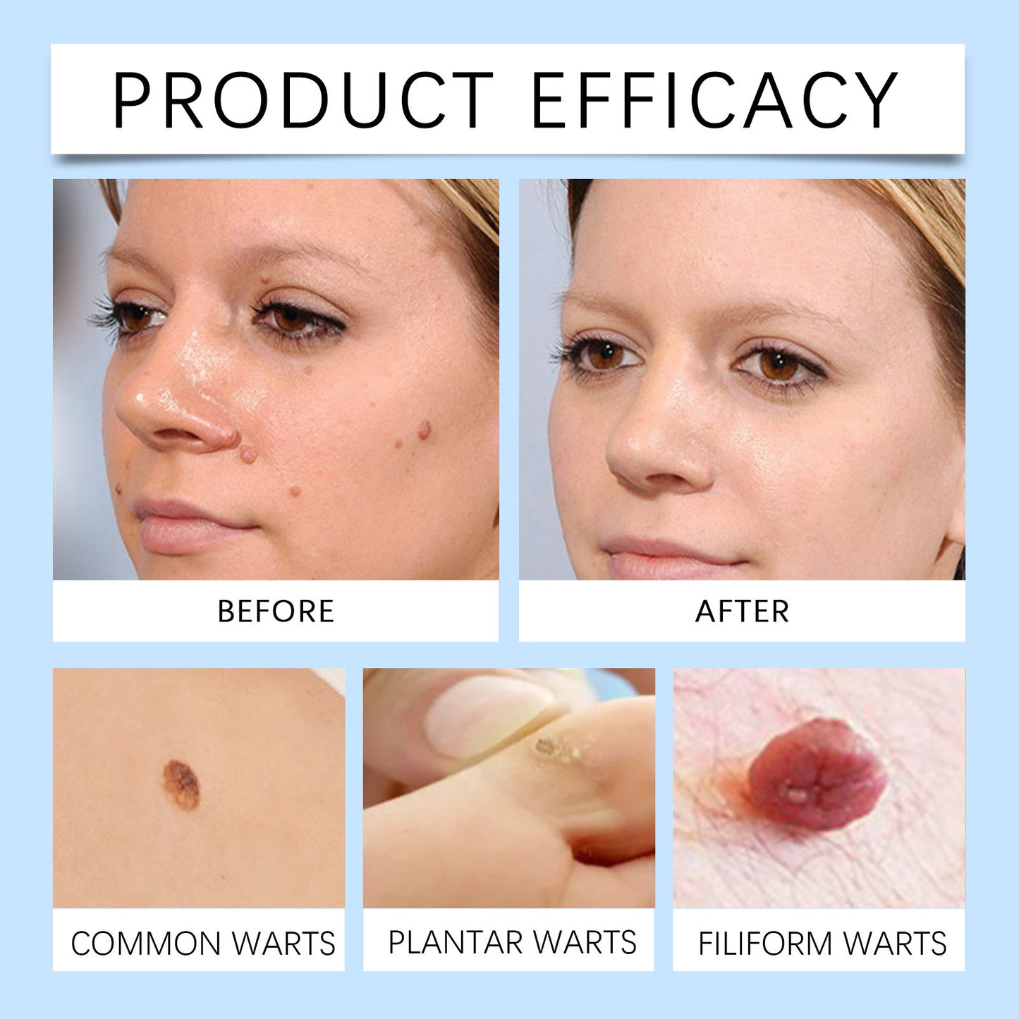 Herbal Keyou Cream Improves Skin Quality Smooth And Gentle e74d7c9d c599 4b2e 8423 9e5e5999f9bc