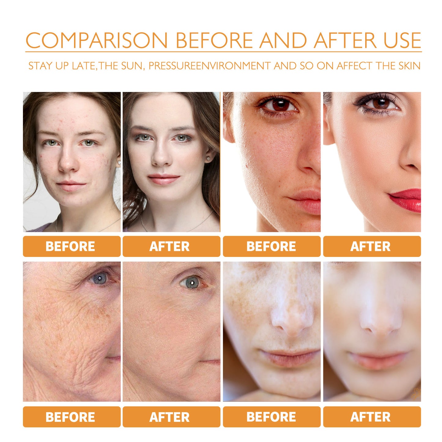 Turmeric Facial Smallpox Diluting Refreshing Oil Control f84c3593 090c 4712 a578 97848442de49