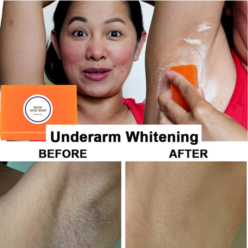 Cleansing Acne Removing Mites Moisturizing And Brightening Soap fa7ed387 904b 4359 9489 813826b65977