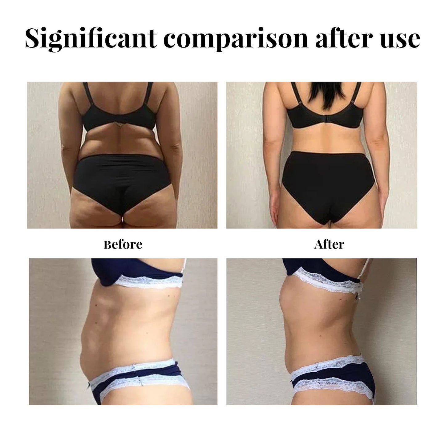 Abdominal Lifter Loose Skin Firming Slim Fit fdc23910 20bc 4847 8995 982db9c454c7