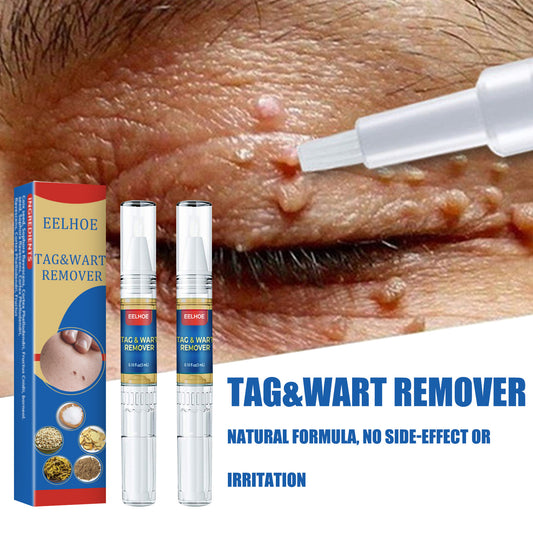 Skin Remove Nevus Pen To Liquid Body Skin Tags 03af3a45 702b 407d bac9 1488c89397ba