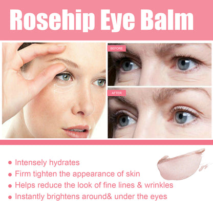 Rose Fruit Eye Cream Stick Fade Fine Lines Of Eye Bags 05b6f239 e544 415c 83ca 7cbd5c1901ad