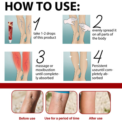 Earthworm Leg Vein Massage Cream For Relieving Leg Vascular Protrusion And Leg Swelling 0b129818 491b 4908 bc81 2714bda864b4