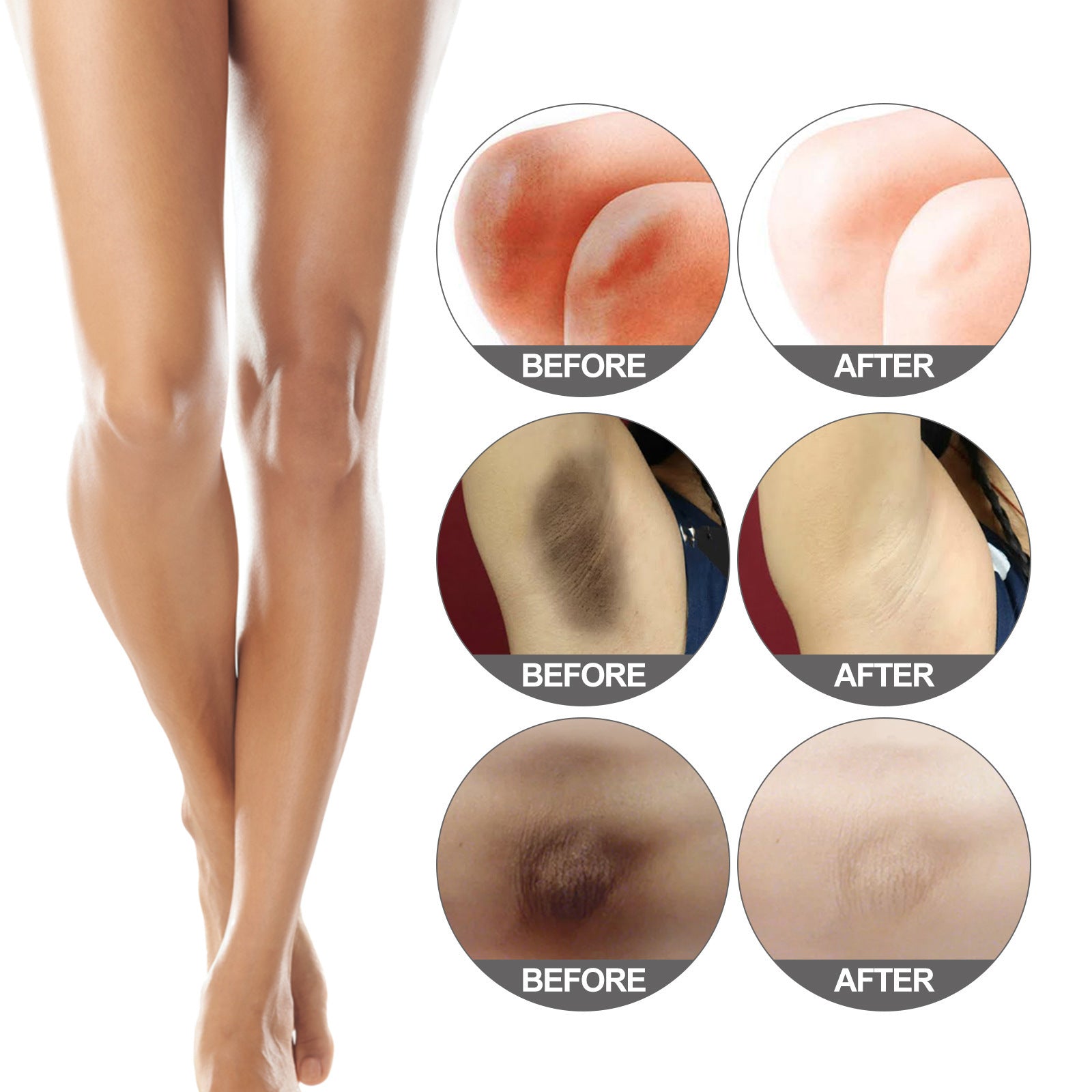 Fade Elbow Knee Joint Black Exfoliating Whitening Skin Beauty 10bb0037 5b6b 4188 bcca 918d114d5142