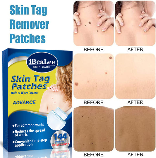 Mole Removal Nursing Adhesive Bandage Applicable Body 11b1779e 2617 40e5 9f08 1cd5ea1012c0