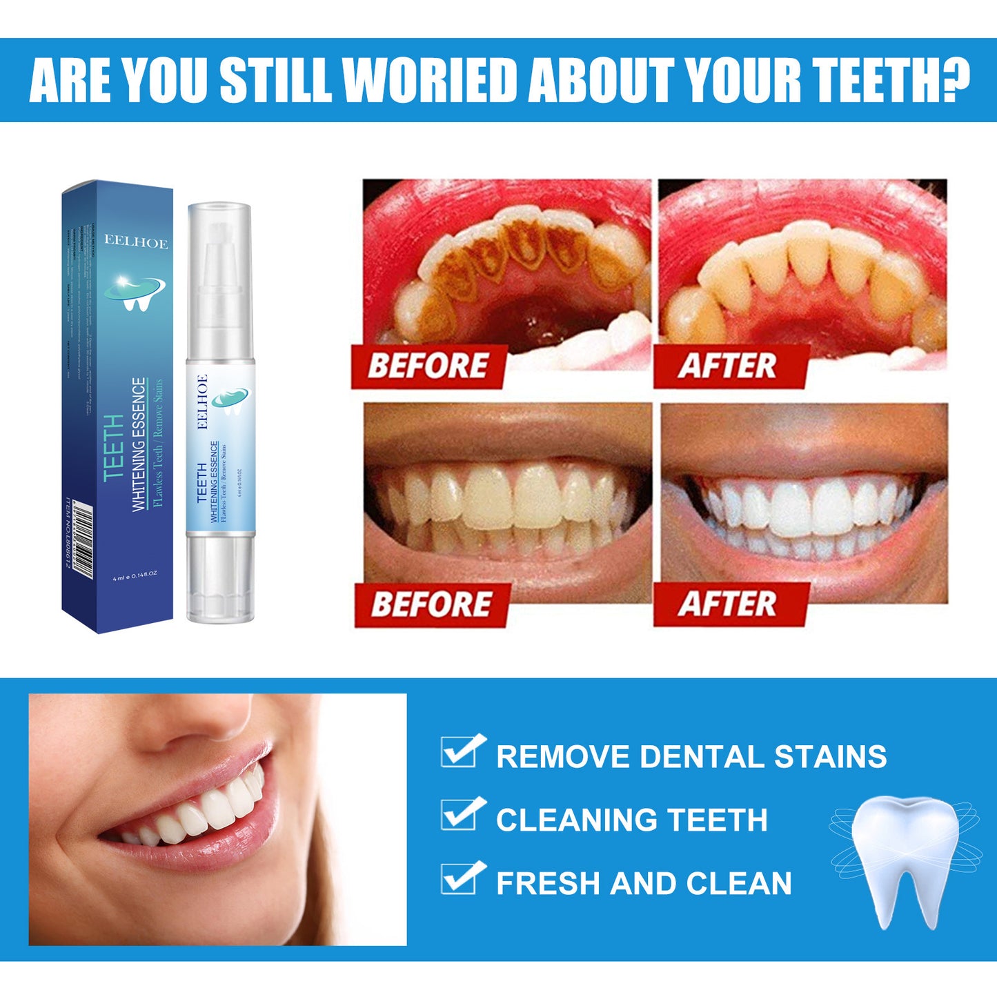 Oral Cleaning Dental Plaque Cleaning White Teeth Teeth Whitening Pen 12918f45 8721 43d2 896b 7c4240ffe626