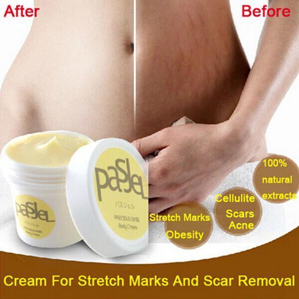 Scar Removal and Stretch Mark Cream 1361663456166