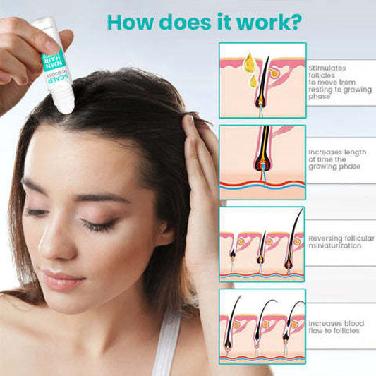 ScalpReboost NMN Hair Growth Roller 140fb053 50ae 468f b533 07dffc33fe3f