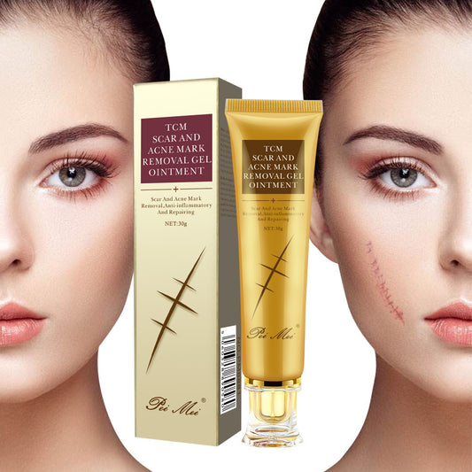 Light Scar Cream Scar Fine Grain Desalination Skin Care Products 146264739935
