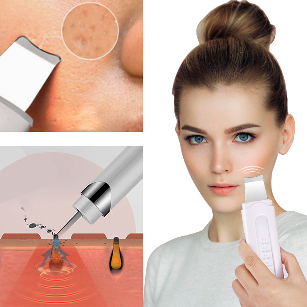 Electric Pore Cleaning Ultrasonic Peeling Machine 1617016070082