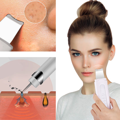 Electric Pore Cleaning Ultrasonic Peeling Machine 1617016070082