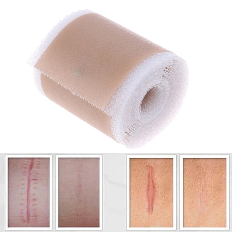 Skin Color Silicone Gel Tape Ear Tape 1620022926230