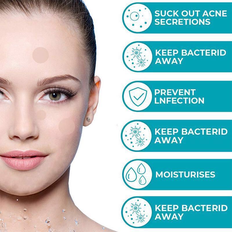 Waterproof Water Gel Acne Patch To Reduce Acne Marks 1620278245290