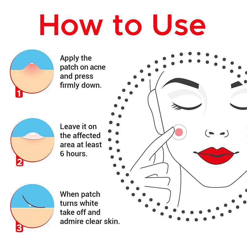Waterproof Water Gel Acne Patch To Reduce Acne Marks 1620278245293