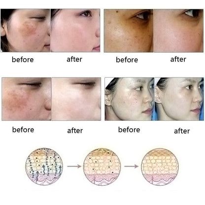 Dredge Meridian Skin Care Natural Pure Removal Acne Stretch Marks Scar Removal Essence oil 1768544549010
