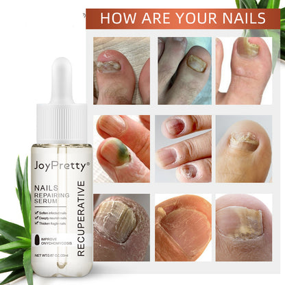 Liquid Nourishing Anti-Barb Bright Nail Polish 17cefbaa 2fc8 4d3b 8981 e4abe0f428aa