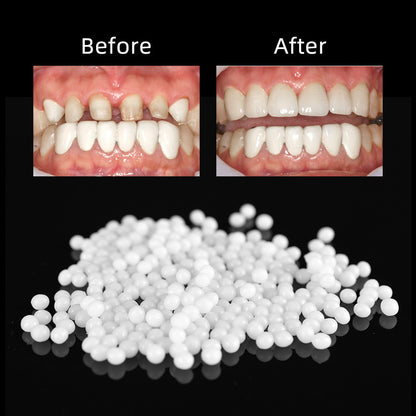 Bagged Household Teeth Repair Solid Hot-soluble Teether Temporary Repair Missing Teeth Gap 1b5ccd0b 2e27 41c2 97db f25e308edd