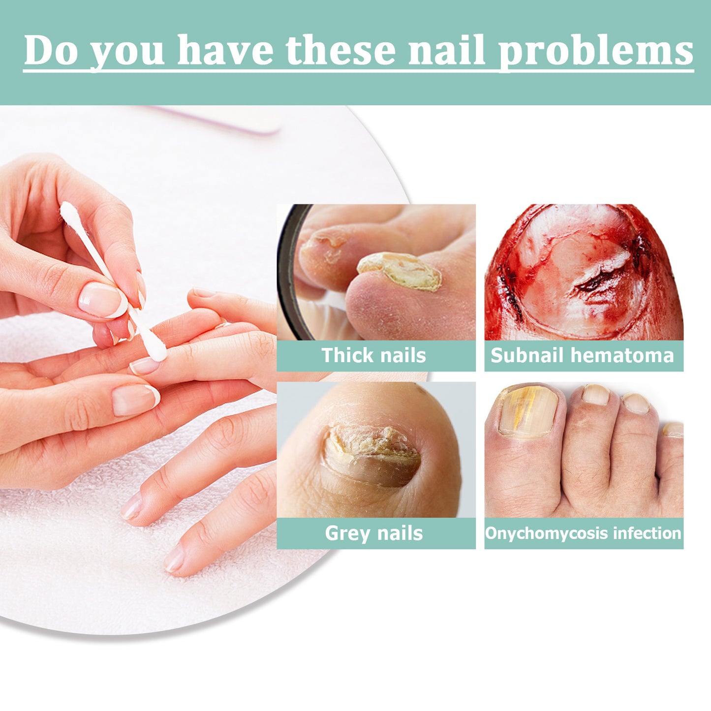 Nail Repair Pen Nail Removal Dead Skin Barbed Moisturizing Repair Pen 1e59f78d 9c24 4e5b 9071 6bea7bbc10b0