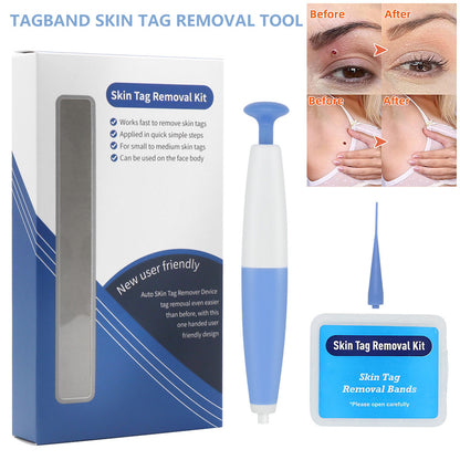 Skin Tag Removal Kit Home Use Mole Wart Remover Micro Band Skin Tag Treatment Tool Easy To Clean Skin Care Tool 20979715 6faf