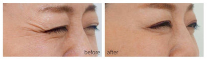 Household facial mask photon acne rejuvenation instrument 22974835714877