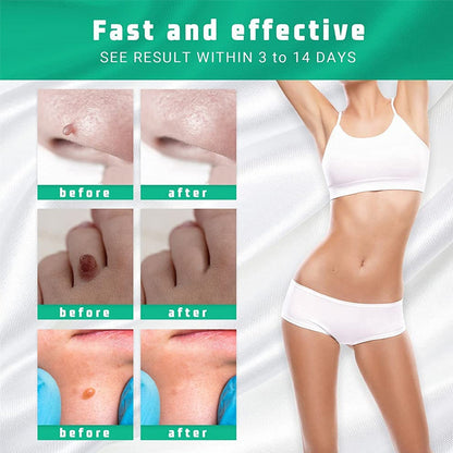 Moisturizing Facial Wart Remover 2401290900310322300