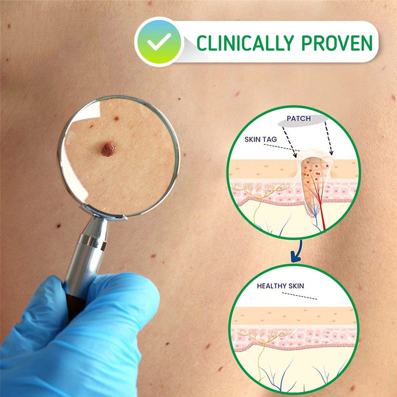 Moisturizing Facial Wart Remover 2401290900310324600