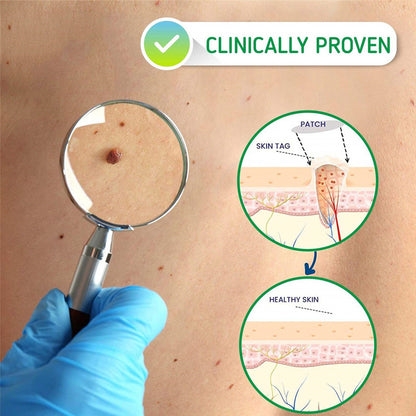 Moisturizing Facial Wart Remover 2401290900310324600