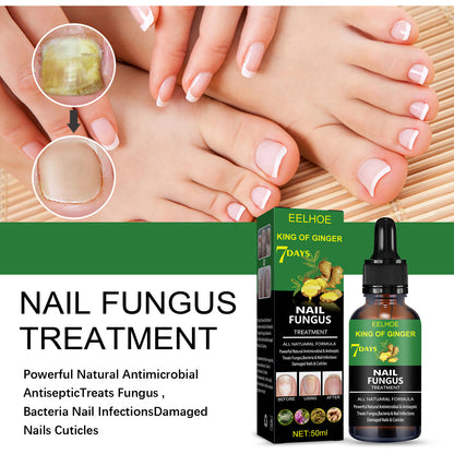Nail Repair Solution Hand Foot And Nail Care Solution 2a19fca9 6216 4cf8 bf00 a96bbc433856