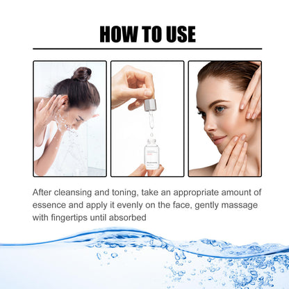Niacin Facial Pore Shrink Smallpox Diluting Hydrating Moisturizing Whitening Skin Beauty 2ca2df63 4247 4428 b268 8ecee9fe5aae
