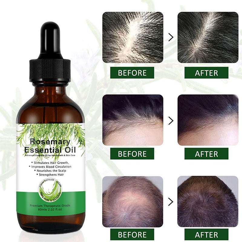Rosemary Hair Growth 2ca62ec1 53e3 4e20 80d6 fbf9953837d6