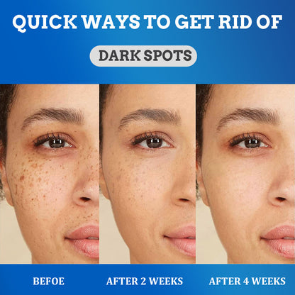 Fade Spot Cream Brightening White Moisturizing Cream 30bf7e63 5b80 435e 81e2 bf350e7b8859