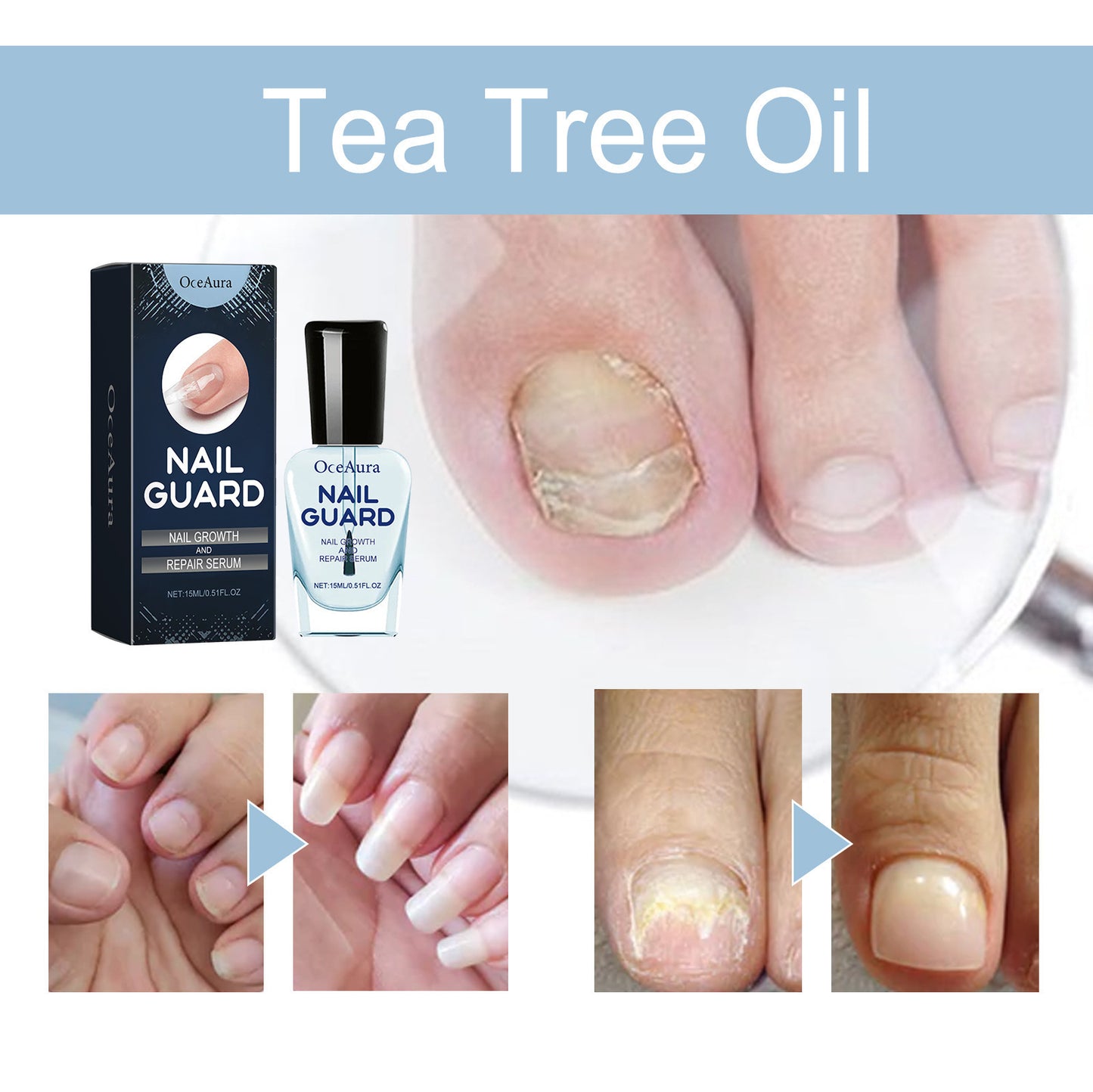 Hand And Foot Nail Nutrition Moisturizing Repair Soft Nail Gentle Cleaning Bright Nail Care 3d5148cb a810 43bc 94e7 f7926bf83