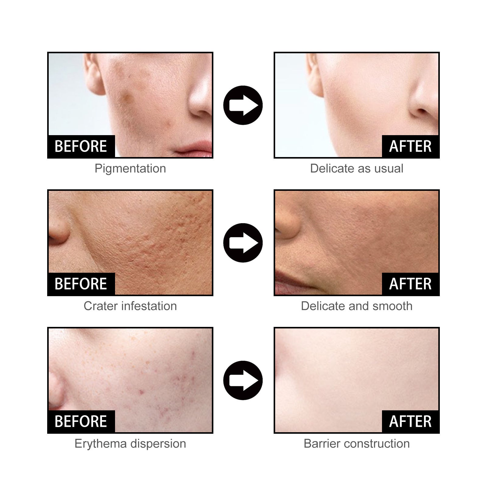 Niacin Facial Pore Shrink Smallpox Diluting Hydrating Moisturizing Whitening Skin Beauty 404b0947 e4ab 4d61 be0c 69d657b93a0e