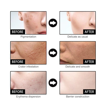 Niacin Facial Pore Shrink Smallpox Diluting Hydrating Moisturizing Whitening Skin Beauty 404b0947 e4ab 4d61 be0c 69d657b93a0e