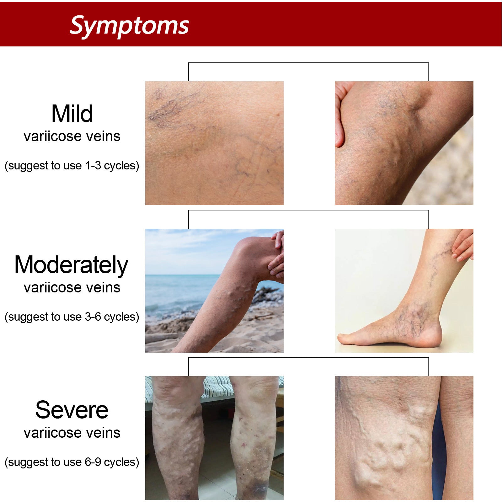 Earthworm Leg Vein Massage Cream For Relieving Leg Vascular Protrusion And Leg Swelling 40c2f0de 45d4 4b95 af23 7f50b80d6015
