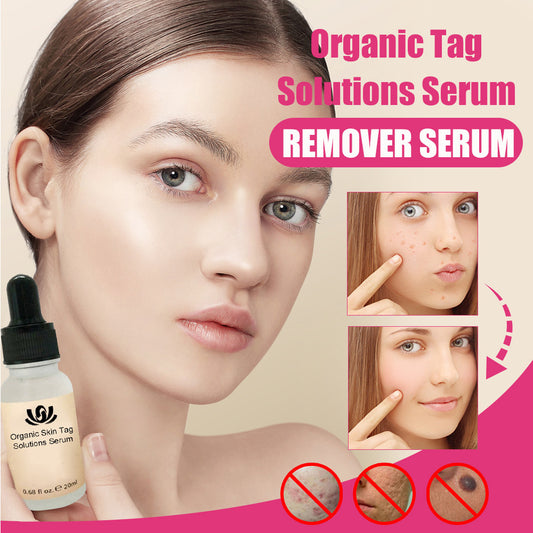 Organic Tags Solutions Serum No Trace Painle Skin Tag Remover Serum Mole Removal Cream Painless Face Wart Mole Freckle 443207