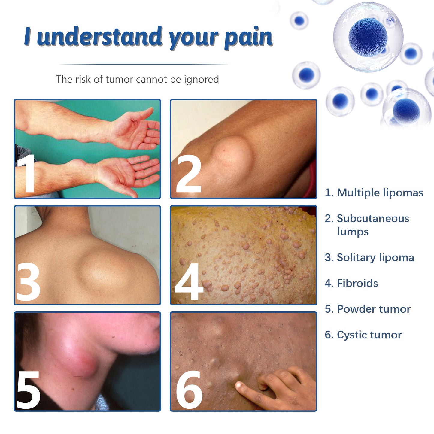 Repair Fat Care Relieve Fat Mass Repairing Cream 492d5c36 3945 4aac a6e5 ac8096ea6179