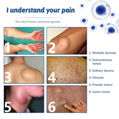 Repair Fat Care Relieve Fat Mass Repairing Cream 492d5c36 3945 4aac a6e5 ac8096ea6179